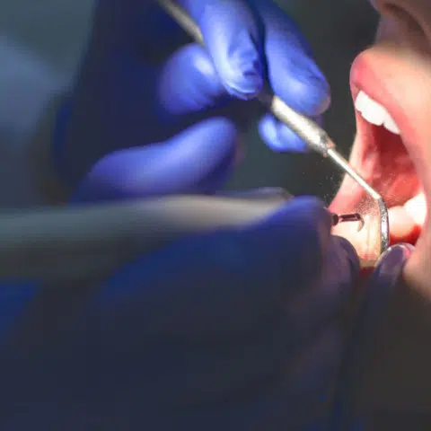 Patient getting a deep teeth cleaning