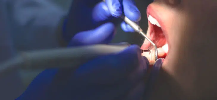 Patient getting a deep teeth cleaning
