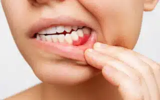 Cropped shot of a young woman showing red bleeding gums isolated on a white background