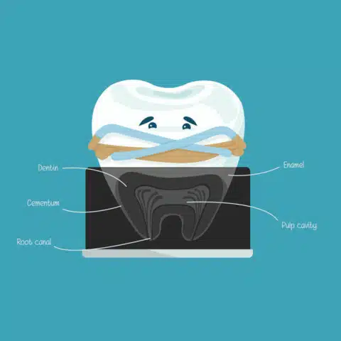 Graphic of a tooth showing anatomy