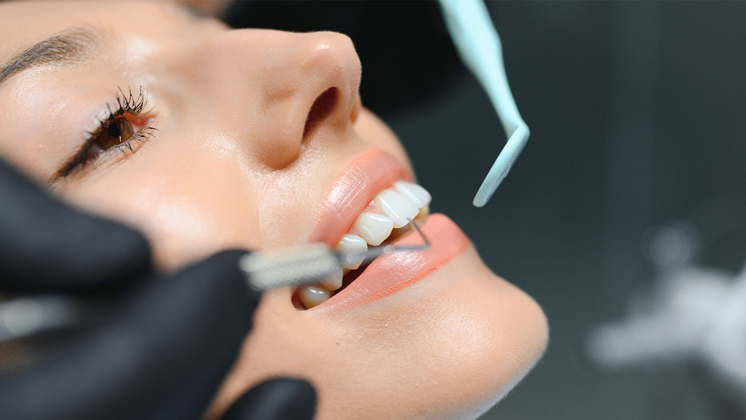 Cosmetic Dentistry Procedures to Transform Your Smile
