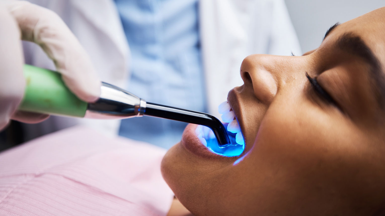 What to Do If a Dental Filling Falls Out